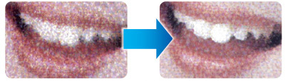 SP4 significantly reduces graininess in halftone areas and produces smooth skin tones.